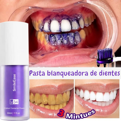 Smile Ease 60 ml | PASTA BLANQUEADORA DENTAL