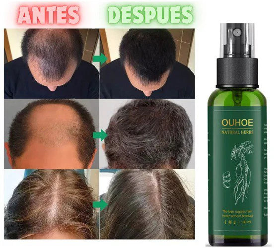 ELIXIR OUHOE™️ CAPILAR. - Dile adiós a los días de cabello opaco y sin vida.